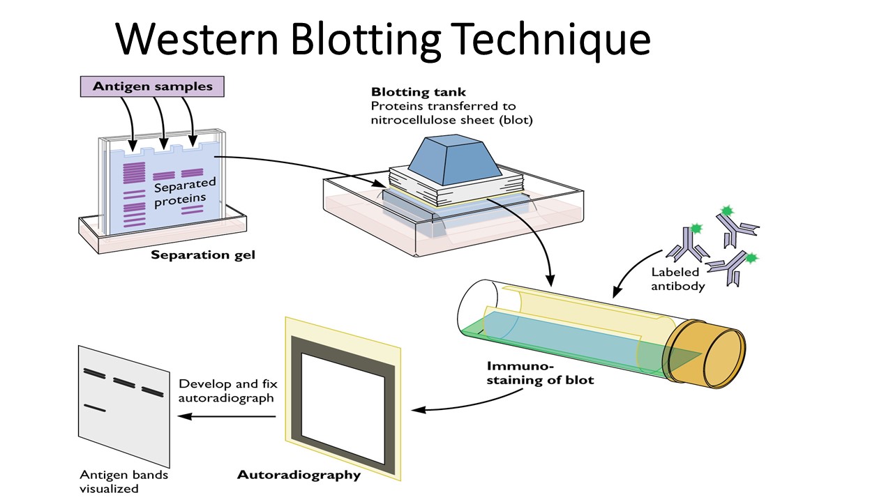 WB(Western Blotting)實(shí)驗(yàn)方法